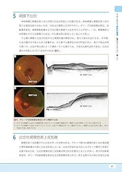 京大眼科版 基礎からのOCT・OCTA入門 | 辻川明孝 |本 | 通販